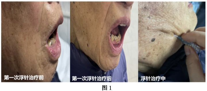 Snipaste_2024-06-21_08-32-57.jpg Snipaste_2024-06-21_08-32-57.jpg