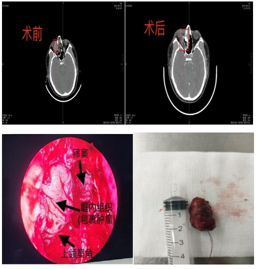 Snipaste_2025-08-28_09-08-25.jpg Snipaste_2025-08-28_09-08-25.jpg